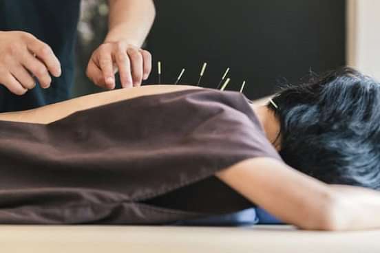 An acupuncture session at YO1, Catskills, New York, demonstrating traditional techniques for pain relief and wellness.