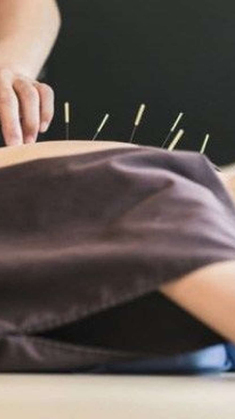 An acupuncture session at YO1, Catskills, New York, demonstrating traditional techniques for pain relief and wellness.