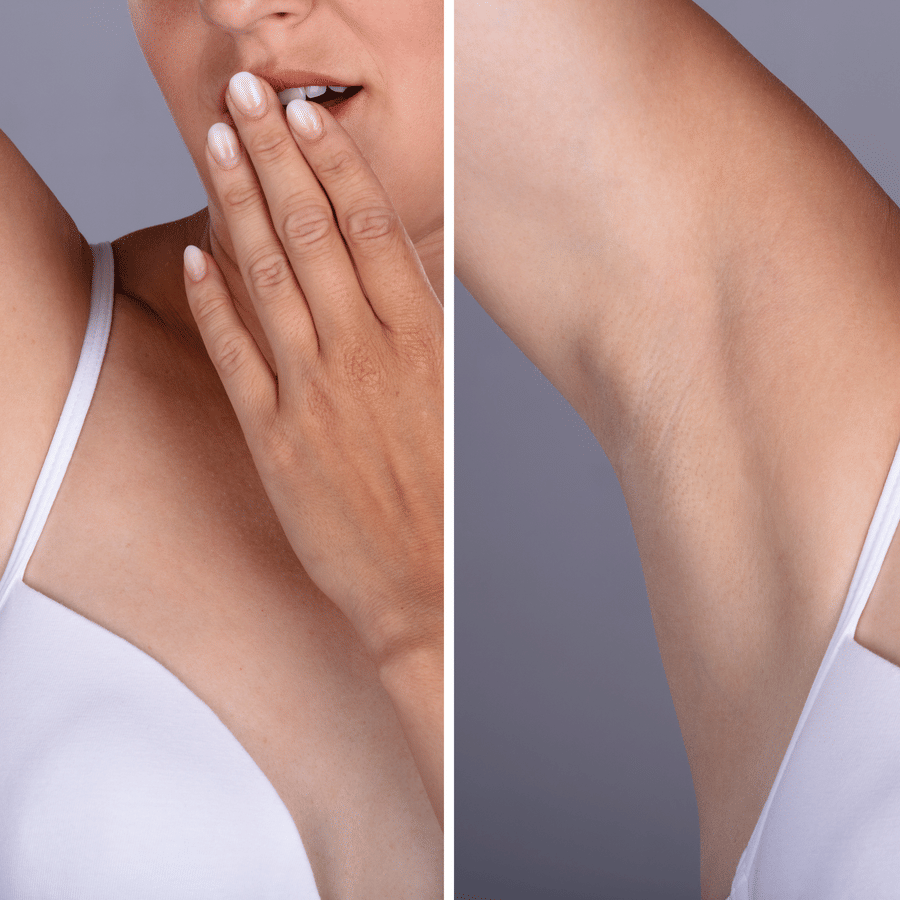 Underarm Radiance