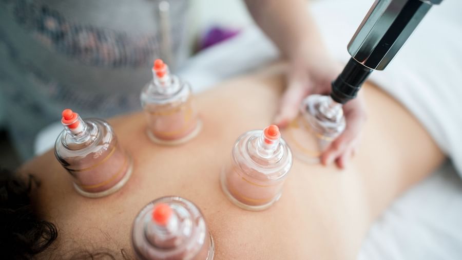A person getting treated with cupping therapy at The Mudhouse Wellness Resort