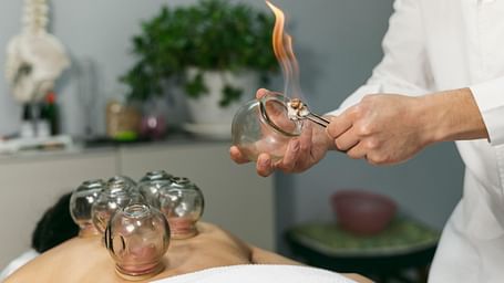 A therapist preparing cupping therapy with a flaming cotton ball inside a glass cup before applying it to a patient's back.
