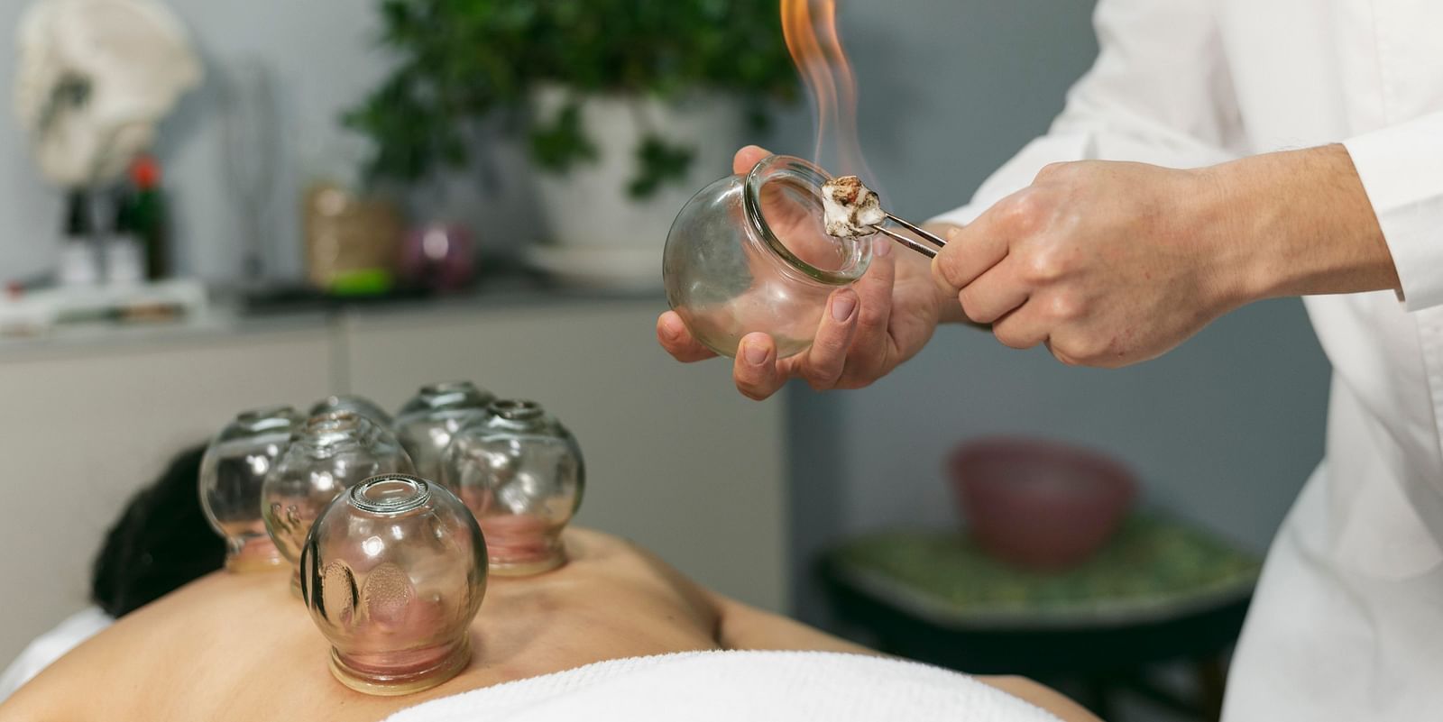 A therapist preparing cupping therapy with a flaming cotton ball inside a glass cup before applying it to a patient's back.