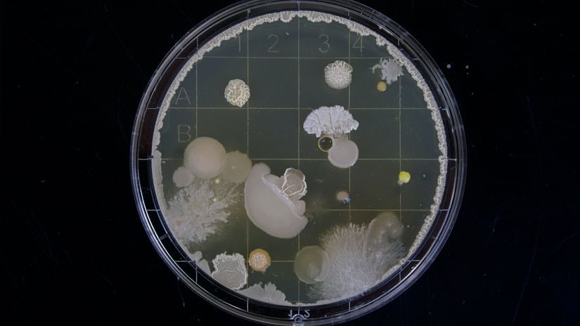 a dish with many types of bacteria breeding inside it - this is used by researchers to understand the bacteria