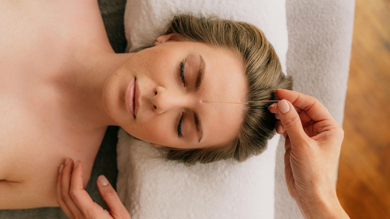 A client with her eyes closed lies on a massage table as a therapist places a thin needle for an acupuncture treatment on her forehead.