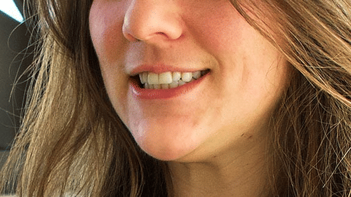 a person's smiling mouth, showing teeth and dimples, with long hair visible at YO1 Longevity & Health Resorts.