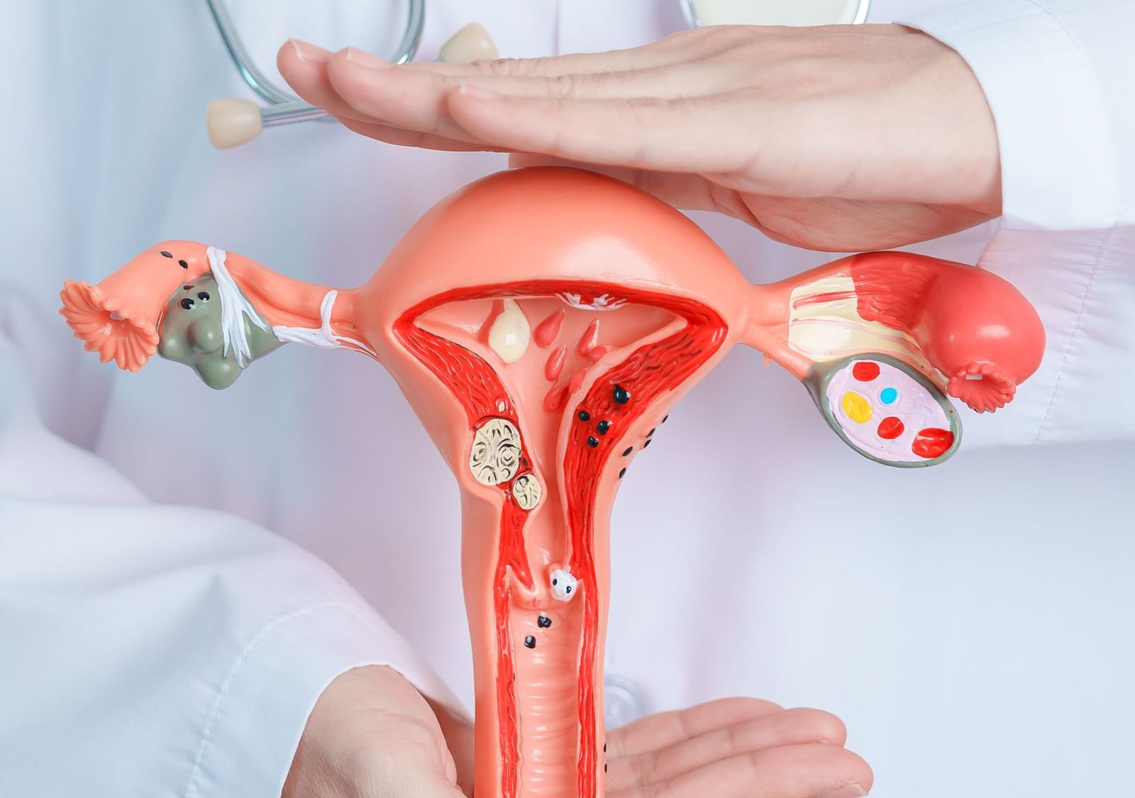 A doctor presenting a 3D model of the female reproductive system - Shreyas Retreat