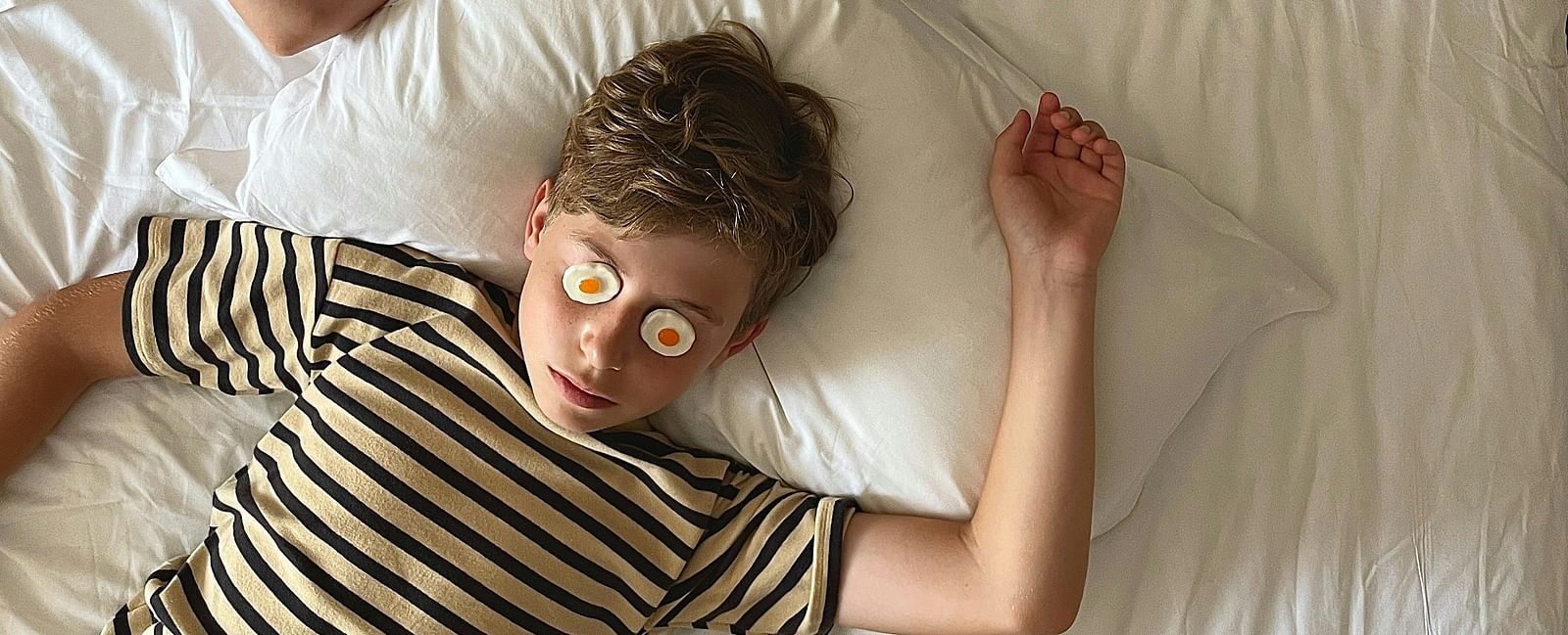 A girl and a boy sleeping in a hotel bed with something in their eyes.