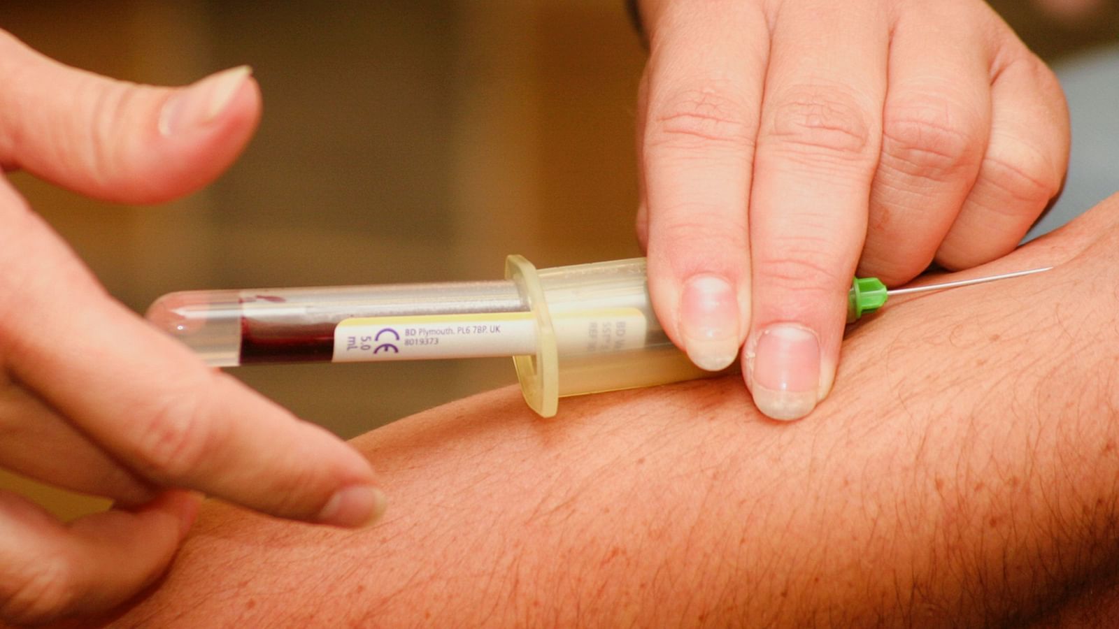 A close up shot of a person taking a blood sample from the veins of another person.