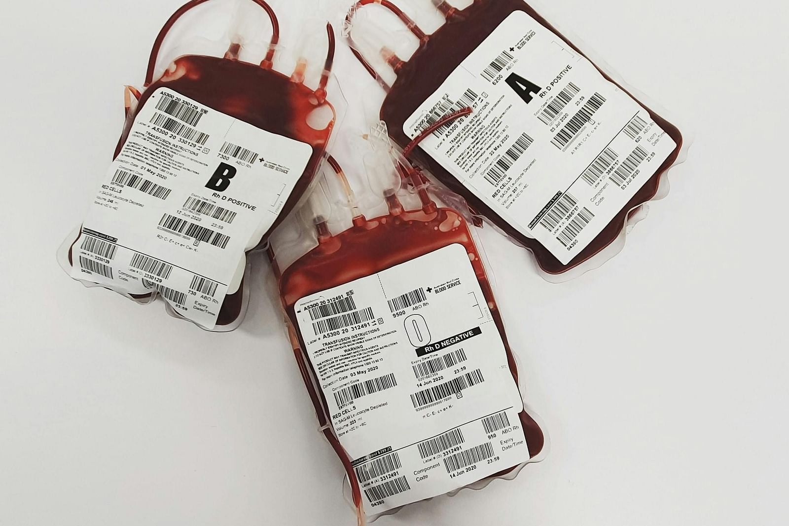 Three bags of blood for transfusion which are labelled with blood types.