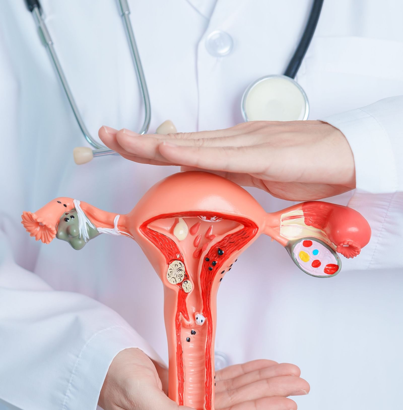A doctor presenting a 3D model of the female reproductive system - Shreyas Retreat