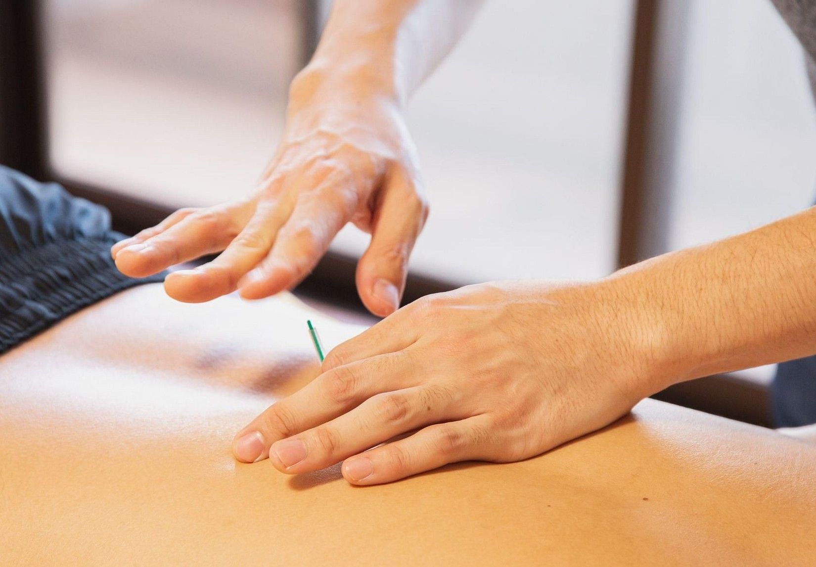 A person receiving acupuncture on their back while lying on their stomach at YO1 Longevity & Health Resorts, Catskills
